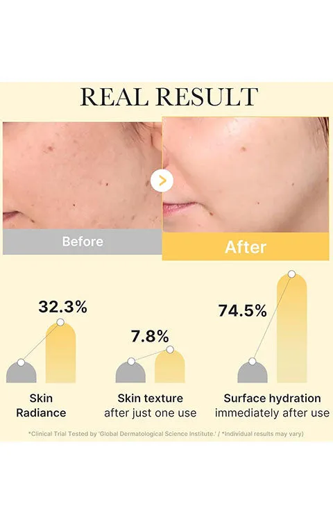 [medicube] Kojic Acid Turmeric Gold Jelly Gel Mask 1Sheet