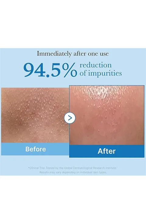 [medicube] Zero Pore Blackhead Deep Cleansing Oil(205Ml/6.93fl.oz)